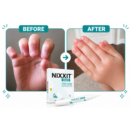 NIXXIT KIDS